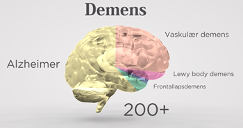 Forskning og viden om demens